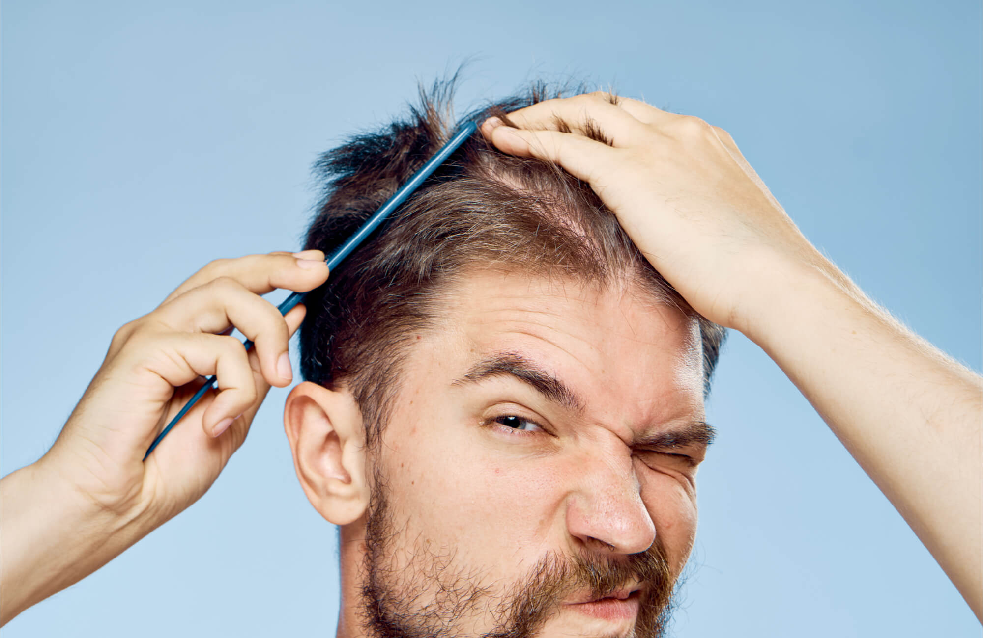 Jangan sering sering pakai POMADE!!! BAHAYA BROO!!