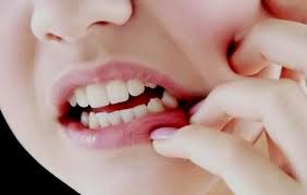 BAHAN ALAMI UNTUK MENGOBATI SAKIT GUSI BENGKAK