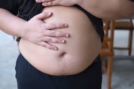 Perlu Kamu Ketahui ini Penyebab Perut Buncit