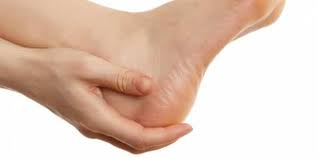 Kaki Kalian Kapalan? Ikuti Tips Berikut Dijamin Sembuh!