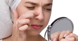 Cara menghilangkan Komedo secara alami