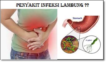 Hati-Hati, Makanan Ini Bisa Memperparah Infeksi Lambung