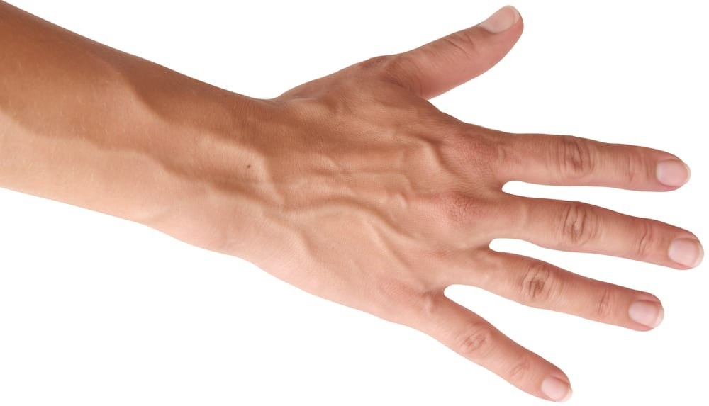 Penyebab urat menonjol dan tampak jelas